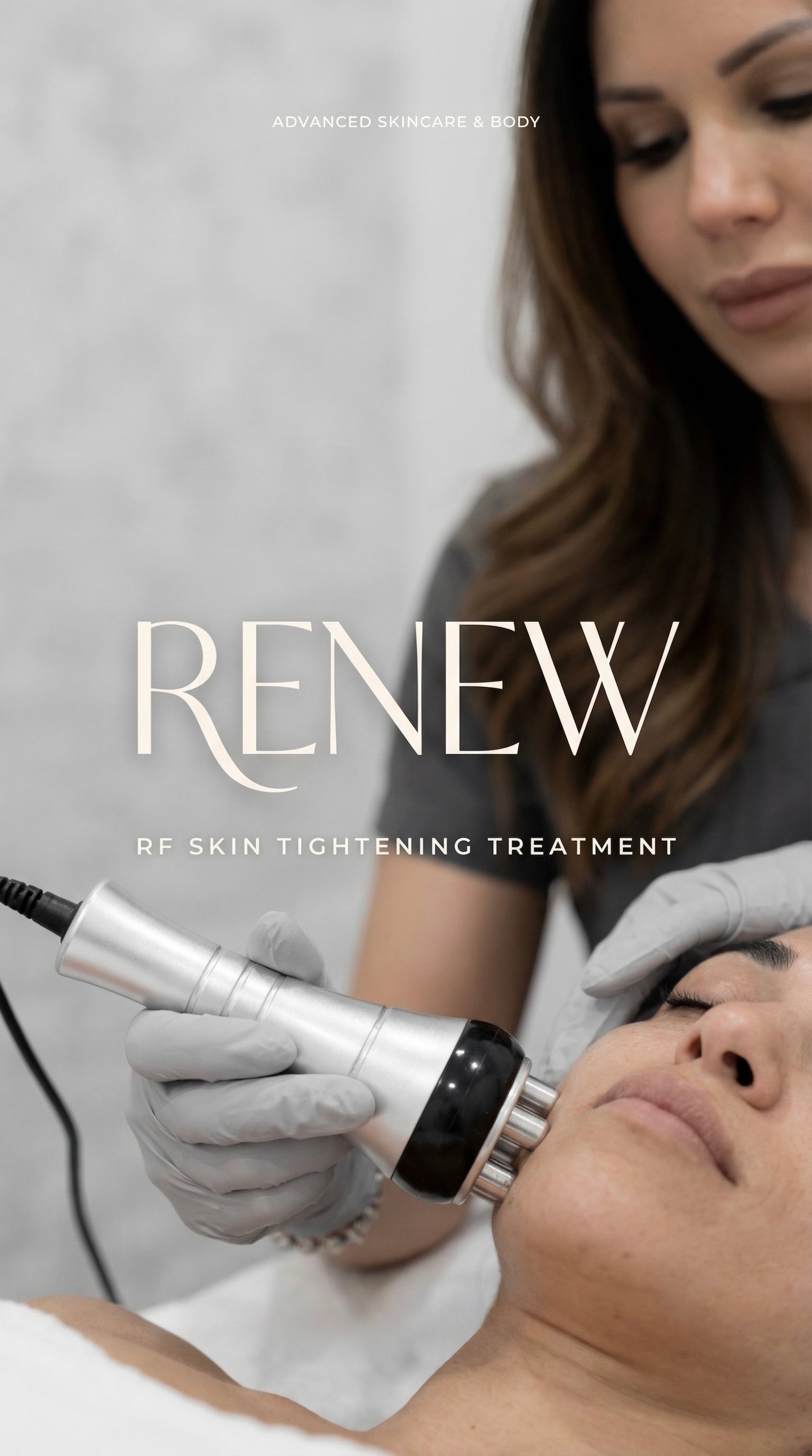 RF Skin Tightening Treatment