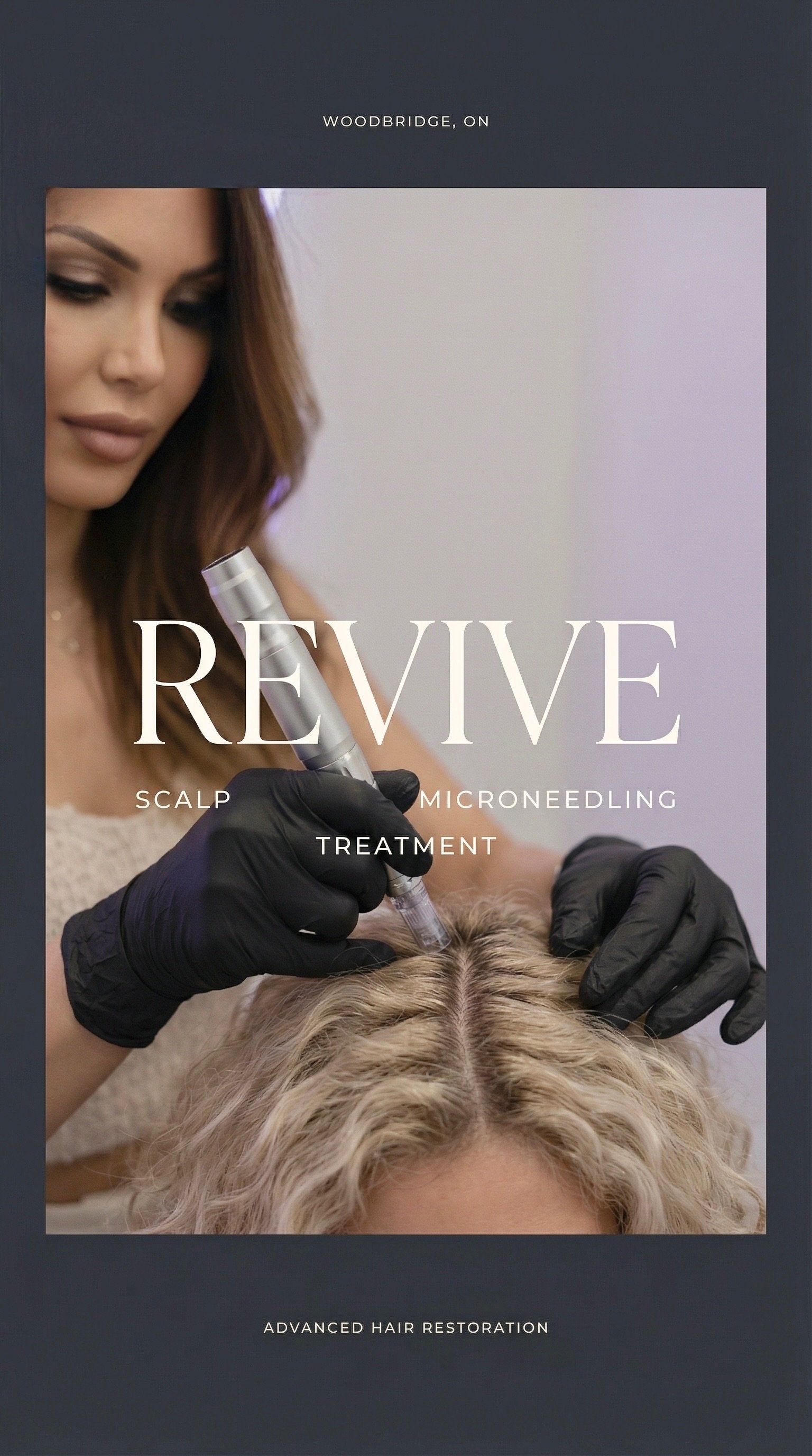 Microneedling treatment session